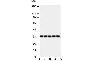 Western blot testing of LOX-1 antibody and Lane 1:  HeLa;  2: SMMC-7721;  3: U87;  4: U937;  5: K562 lysate. (OLR1 抗体  (N-Term))