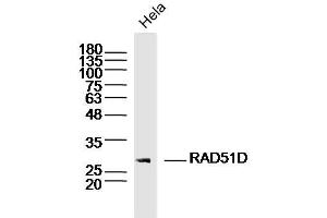 Hela lysates probed with RAD51D Polyclonal Antibody, Unconjugated  at 1:300 dilution and 4˚C overnight incubation. (RAD51D 抗体  (AA 1-100))