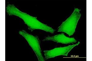 Immunofluorescence of purified MaxPab antibody to DUSP14 on HeLa cell. (DUSP14 抗体  (AA 1-198))