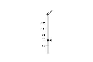 Anti-IDUA Antibody (Center) at 1:1000 dilution + human lung lysate Lysates/proteins at 20 μg per lane. (IDUA 抗体  (AA 236-264))