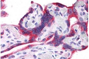 Human Placenta: Formalin-Fixed, Paraffin-Embedded (FFPE) (Leptin 抗体  (N-Term))