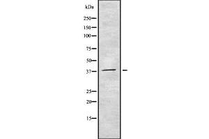 Western blot analysis of CDC123 using COLO205 whole cell lysates (CDC123 抗体  (Internal Region))