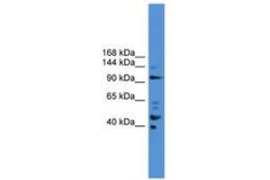 Image no. 1 for anti-Progesterone Immunomodulatory Binding Factor 1 (PIBF1) (AA 601-650) antibody (ABIN6745470) (PIBF1 抗体  (AA 601-650))