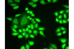Immunofluorescence analysis of U2OS cells using RNF40 antibody. (RNF40 抗体  (AA 1-300))