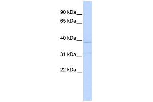 WB Suggested Anti-KCNK15 Antibody Titration:  0. (KCNK15 抗体  (Middle Region))
