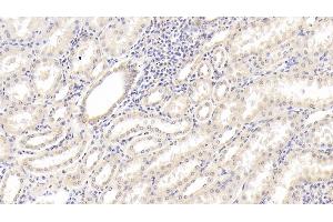 Detection of IL18 in Human Kidney Tissue using Monoclonal Antibody to Interleukin 18 (IL18) (IL-18 抗体  (AA 94-193))