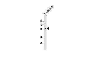 Anti-ACVR2A Antibody (N-term) at 1:1000 dilution + human fetal liver lysate Lysates/proteins at 20 μg per lane. (ACVR2A 抗体  (N-Term))