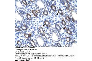 Human kidney (RGS6 抗体  (C-Term))