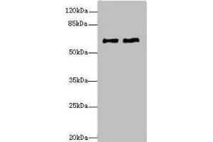 Western blot All lanes: COL9A3antibody at 1. (COL9A3 抗体  (AA 445-684))