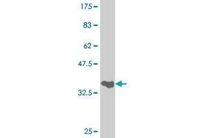 Western Blot detection against Immunogen (34. (FOXA1 抗体  (AA 287-370))