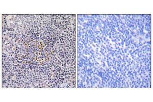 Immunohistochemistry analysis of paraffin-embedded human tonsil tissue using XRCC3 antibody. (XRCC3 抗体  (Internal Region))