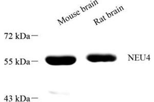 Western blot analysis of NEU4 (ABIN7075594) at dilution of 1: 1000 (Sialidase 4 抗体)