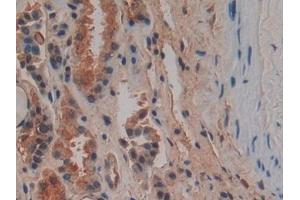 Detection of OPN in Human Kidney Tissue using Polyclonal Antibody to Osteopontin (OPN) (Osteopontin 抗体  (AA 17-287))
