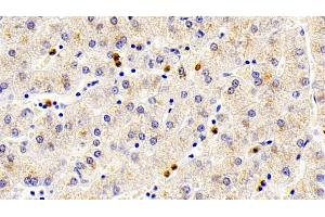 Immunohistochemistry (IHC) image for anti-S100 Calcium Binding Protein A12 (S100A12) (AA 2-92) antibody (ABIN7443992)