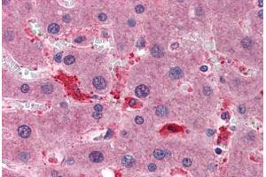 anti-Copper Chaperone For Superoxide Dismutase (CCS) (AA 175-275) antibody