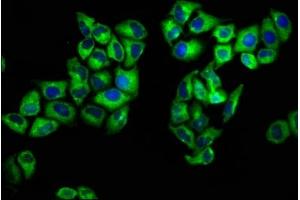 Immunofluorescence staining of Hela cells with ABIN7166495 at 1:133, counter-stained with DAPI. (ROS1 抗体  (AA 79-248))