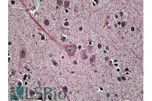 ABIN335168 (3. (SYT1 抗体  (Internal Region))