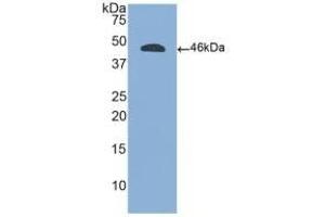 Detection of Recombinant CD45, Human using Polyclonal Antibody to Protein Tyrosine Phosphatase Receptor Type C (CD45) (CD45 抗体  (AA 193-575))
