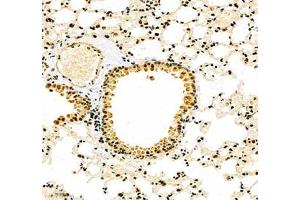 Immunohistochemistry (Paraffin-embedded Sections) (IHC (p)) image for anti-Notch 3 (NOTCH3) antibody (ABIN7074862)