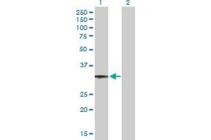 Western Blot analysis of CCDC108 expression in transfected 293T cell line by CCDC108 MaxPab polyclonal antibody. (CCDC108 抗体  (AA 1-271))