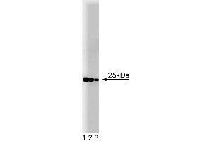 Western blot analysis of Rab4 on a rat cerebrum lysate. (Rab4 抗体  (AA 97-213))