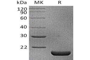 Western Blotting (WB) image for Interleukin 18 (IL18) protein (His tag) (ABIN7320581) (IL-18 Protein (His tag))