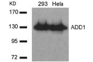 Image no. 3 for anti-Adducin 1 (Alpha) (ADD1) (Ser726) antibody (ABIN197406) (alpha Adducin 抗体  (Ser726))