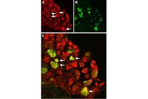 Immunohistochemistry (IHC) image for anti-Transient Receptor Potential Cation Channel, Subfamily V, Member 1 (TRPV1) (AA 824-838), (Intracellular) antibody (ABIN7043841)