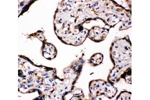 Immunohistochemistry (IHC) image for anti-Cytochrome P450, Family 19, Subfamily A, Polypeptide 1 (CYP19A1) (AA 485-503), (C-Term) antibody (ABIN3044414)