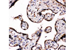 Anti-Aromatase antibody, IHC(P) IHC(P): Human Placenta Tissue