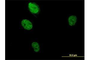 Immunofluorescence of purified MaxPab antibody to RBM5 on HeLa cell.