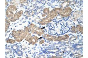 Image no. 1 for anti-Lethal(3) Malignant Brain Tumor-Like Protein 2 (L3MBTL2) (AA 576-625) antibody (ABIN202876) (L3MBTL2 抗体  (AA 576-625))