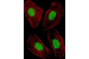 Fluorescent image of  cell stained with NR1H3 Antibody (Center) (ABIN653910 and ABIN2843147). (NR1H3 抗体  (AA 226-253))