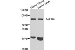 Western blot analysis of extracts of mouse kidney and mouse heart cell lines, using AMPD3 antibody. (AMPD3 抗体)