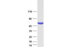 Western Blotting (WB) image for Argininosuccinate Lyase (ASL) (Transcript Variant 2) protein (Myc-DYKDDDDK Tag) (ABIN2714868)