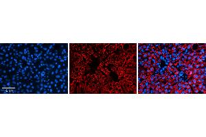 Rabbit Anti-ALDH6A1 Antibody   Formalin Fixed Paraffin Embedded Tissue: Human Liver Tissue Observed Staining: Cytoplasm in hepatocytes Primary Antibody Concentration: N/A Other Working Concentrations: 1:600 Secondary Antibody: Donkey anti-Rabbit-Cy3 Secondary Antibody Concentration: 1:200 Magnification: 20X Exposure Time: 0. (ALDH6A1 抗体  (Middle Region))