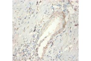 Immunohistochemistry of paraffin-embedded human prostate tissue using ABIN7152807 at dilution of 1:100 (FGF21 抗体  (AA 29-209))