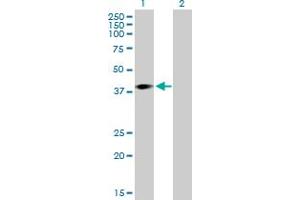 Western Blot analysis of ARPM1 expression in transfected 293T cell line by ARPM1 MaxPab polyclonal antibody. (ARPM1 抗体  (AA 1-372))