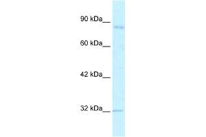WB Suggested Anti-BRD2 Antibody Titration:  2. (BRD2 抗体  (C-Term))