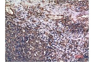 Immunohistochemical analysis of paraffin-embedded Human Tonsil Tissue using Cyclin B1 Mouse mAb diluted at 1:200. (Cyclin B1 抗体)