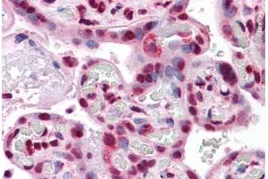 anti-Protein Phosphatase 1, Regulatory (Inhibitor) Subunit 2 (PPP1R2) (AA 1-101) antibody