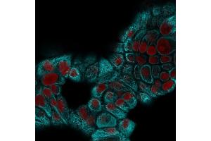 Confocal immunofluorescence image of MCF-7 cells using Cytokeratin 15 Mouse Monoclonal Antibody (KRT15/2959) followed by Goat anti-Mouse CF488 (Cyan) and Reddot is used to label the nuclei Red. (KRT15 抗体)