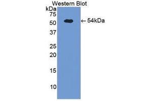 Detection of Recombinant SELE, Porcine using Polyclonal Antibody to E-selectin (Selectin E/CD62e 抗体  (AA 260-420))