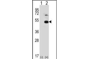 Western blot analysis of TRIP13 (arrow) using rabbit polyclonal TRIP13 Antibody (N-term) (ABIN389357 and ABIN2839463). (TRIP13 抗体  (N-Term))
