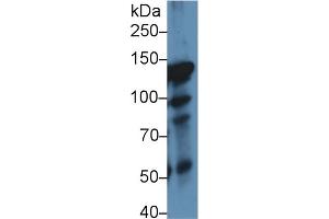 Western Blot; Sample: Rat Lung lysate; Primary Ab: 1µg/ml Rabbit Anti-Rat ITIH4 Antibody Second Ab: 0. (ITIH4 抗体  (AA 478-722))