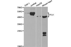 Western blot analysis of extracts of various cell lines, using FLI1 antibody. (FLI1 抗体)