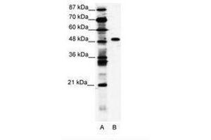 Image no. 1 for anti-Zinc Finger Protein 541 (ZNF541) (AA 783-832) antibody (ABIN203199) (ZNF541 抗体  (AA 783-832))