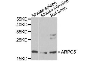 Western blot analysis of extracts of various cell lines, using ARPC5 antibody (ABIN5996446) at 1/1000 dilution. (ARPC5 抗体)