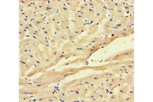 Immunohistochemistry of paraffin-embedded human heart tissue using ABIN7153010 at dilution of 1:100 (FSTL1 抗体  (AA 176-285))