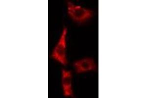 ABIN6279421 staining A549 cells by IF/ICC. (EIF3S1 抗体  (Internal Region))